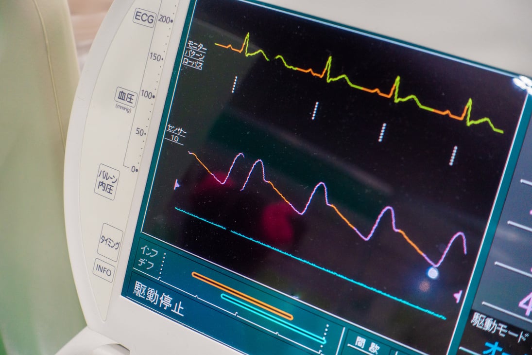 Image of electrocardiogram